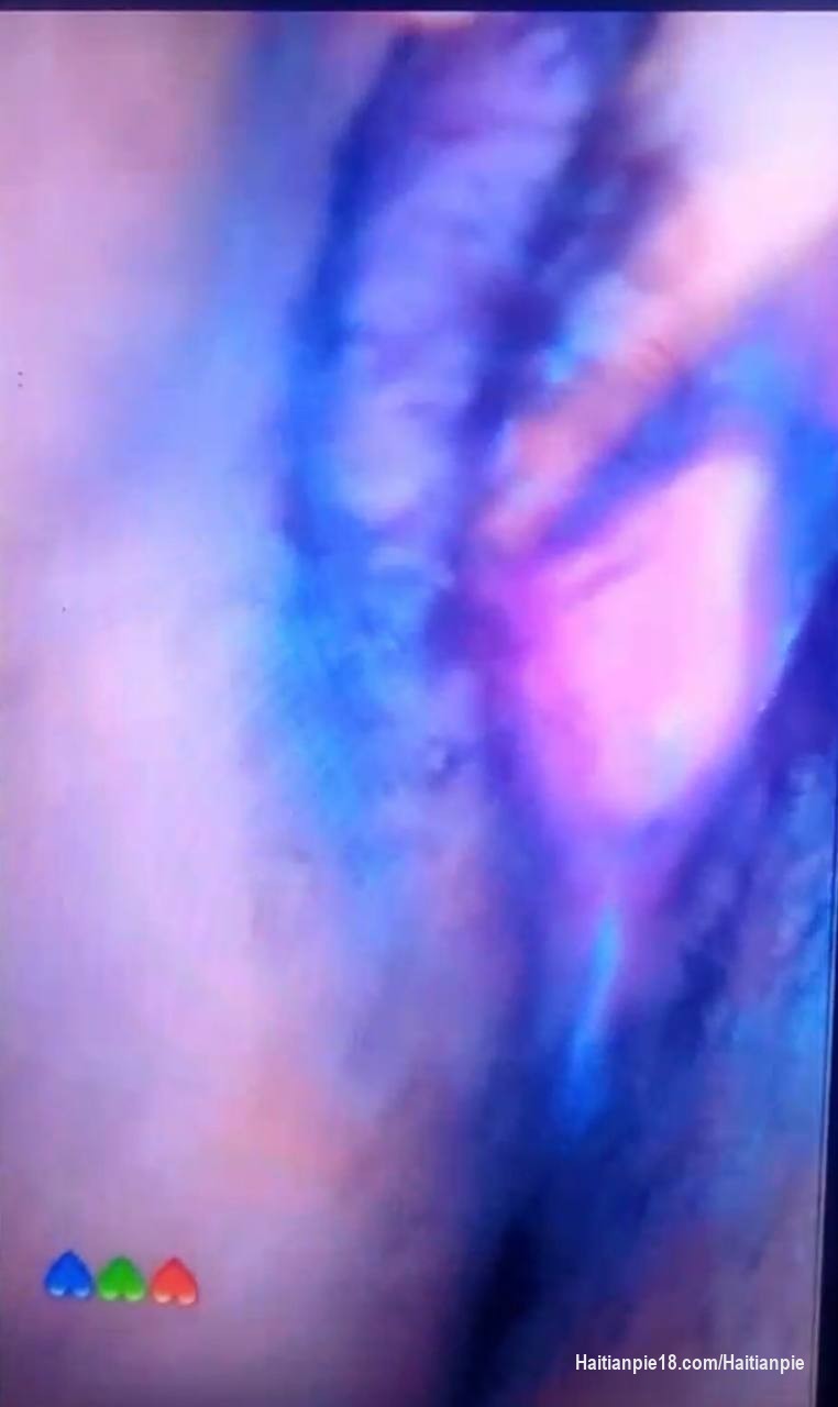 DINA